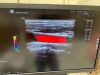 GE HEALTHCARE L2-9-D Ultrasound Transducer