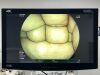 FUJINON Scope  Model: EC-600WM Colonoscope