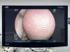 FUJINON Scope  Model: EC-600WM Colonoscope