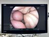 FUJINON Scope Model: EC-600WM Colonoscope Colonoscope