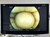 FUJINON Scope Model: EC-600WM Colonoscope Colonoscope
