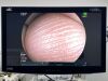 FUJINON Scope Model: EC-600WM Colonoscope Colonoscope