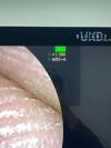 FUJINON Scope Model: EC-600WM Colonoscope Colonoscope