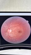 TOPCON TRC NW-400 Fundus Camera