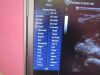 GE Portable Ultrasound Machine w/ Probe & Docking DR