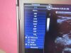 GE Portable Ultrasound Machine w/ Probe & Docking DR