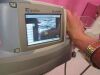 SONOSITE Portable Ultrasound Machine iLook 25 Portable Vascular PICC Ultrasound System w/ L25 Probe   Stand