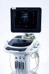 PHILIPS Sparq USG Machine