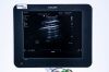 PHILIPS Sparq USG Machine