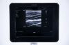 PHILIPS Sparq USG Machine