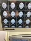 MEDTRONIC StealthStation TREON plus Surgical Navigation System