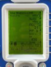 ZOLL 731 ventilator, YOM: 2019 Ventilator