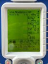 ZOLL 731 ventilator, YOM: 2019 Ventilator