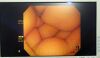 ADVAN AMM215WTD Monitor