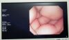 ADVAN AMM215WTD Monitor