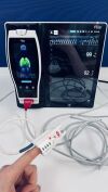 MASIMO RADICAL 7 Oximeter - Pulse