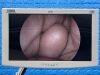 KARL STORZ H3-P Urology Camera Head With Brand New Cable O/R Camera