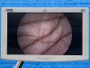 KARL STORZ H3-P Urology Camera Head With Brand New Cable O/R Camera