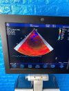 GE VIVID S6  YOM: 2013 Includes: M4S Cardiac Probe  Ultrasound