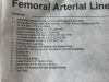TELEFLEX Femoral Arterial Line Catheterization  UM-04018   Exp.2025-04  (AA7) Femoral Arterial Line Catheterization