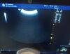 GE C1-5-RS Convex Probe. (2017). Ultrasound Transducer