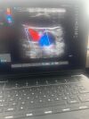 SONOSITE Edge 2 ultrasound  3 probes