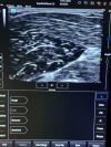 MINDRAY TE7 Ultrasound - Shared Service