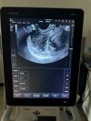 MINDRAY TE7 Ultrasound - Shared Service