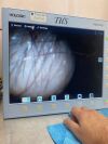 STORZ 20045020 / 20212134 / 20200043 / 20200032/ 20040240 Endoscope