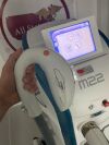 LUMENIS M22 Laser - IPL