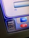 LUMENIS M22 Laser - IPL