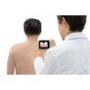 CASIO Dermocamera Microscope