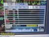 NIHON KOHDEN 2018  Lifescope BSM-6301A Monitor AY-653P Module