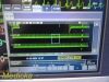 NIHON KOHDEN 2018  Lifescope BSM-6301A Monitor AY-653P Module
