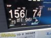 NIHON KOHDEN 2018  Lifescope BSM-6301A Monitor AY-653P Module