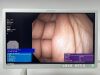 OLYMPUS Scope Model: GIF-H190N Laparoscope