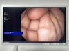 OLYMPUS Scope Model: GIF-H190N Laparoscope