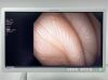 OLYMPUS Scope Model: GIF-H190N Laparoscope