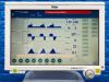 DRAEGER V500, YOM: 2015 Ventilator