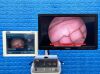 KARL STORZ Tower Laparoscope