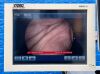 KARL STORZ Tower Laparoscope