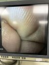 OLYMPUS Evis Exera II CV-180/CLV-180 w/  UES-40 SurgMaster Video System Center