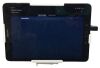 ECHONOUS P005195 PORTABLE TABLET BLADDER ULTRASOUND W/ CART @