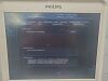 PHILIPS CX50 Ultrasound - Cardiac