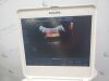 PHILIPS CX50 Ultrasound - Cardiac