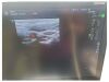 GE LOGIQ S8 Ultrasound - Shared Service