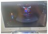 GE LOGIQ S8 Ultrasound - Shared Service