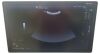 GE LOGIQ S8 Ultrasound - Shared Service