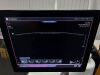 GE Invenia ABUS Automated Breast Ultrasound System