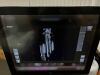 GE Invenia ABUS Automated Breast Ultrasound System